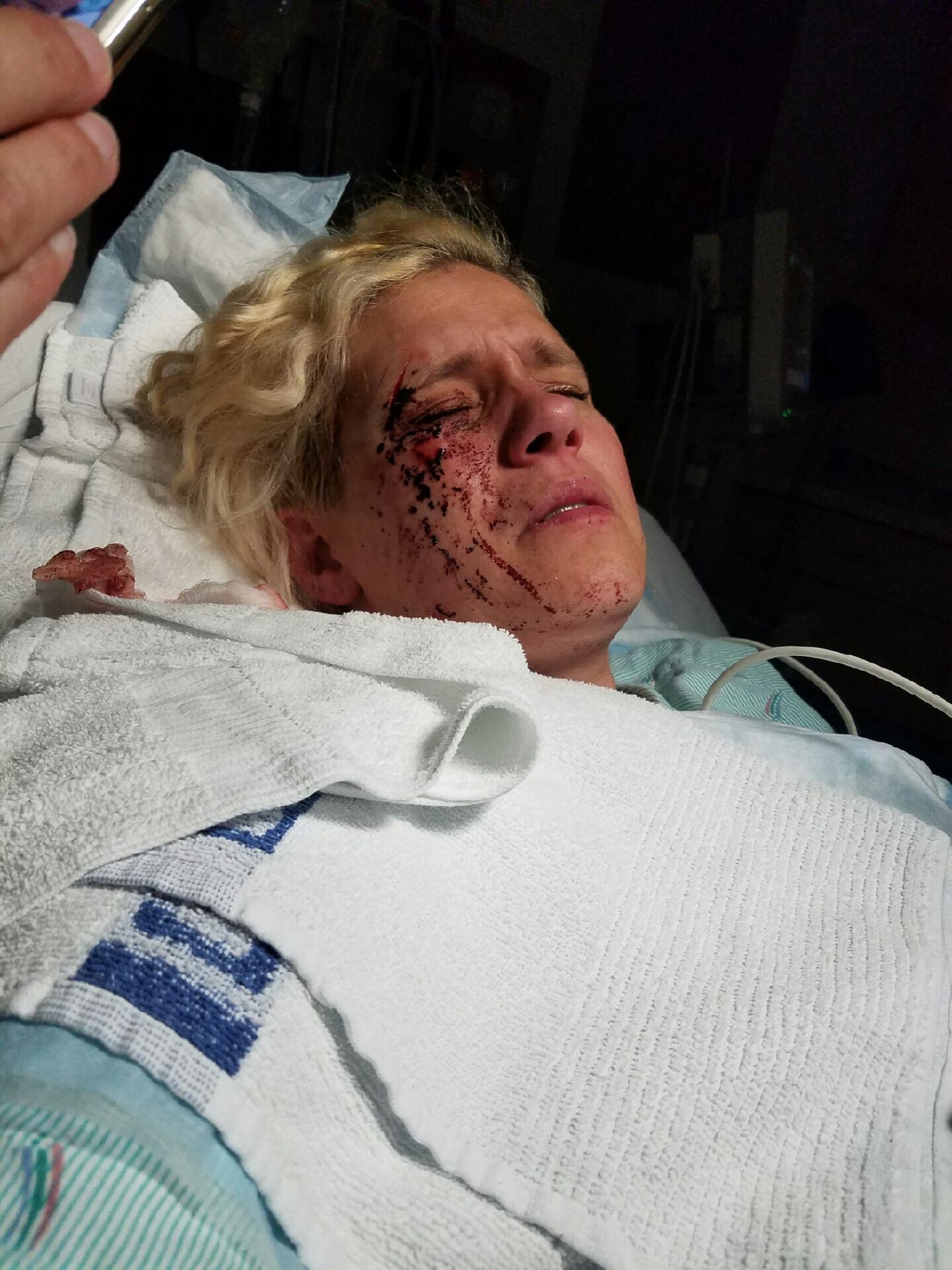 Seattle Pd Fbi Investigating Hate Crime After Transgender Person Attacked On Capitol Hill Komo